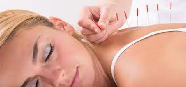 Acupuncture Clinic In Delhi