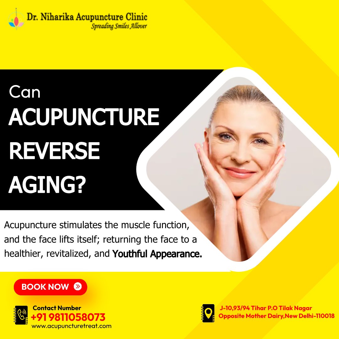 Acupuncture Clinic In Delhi