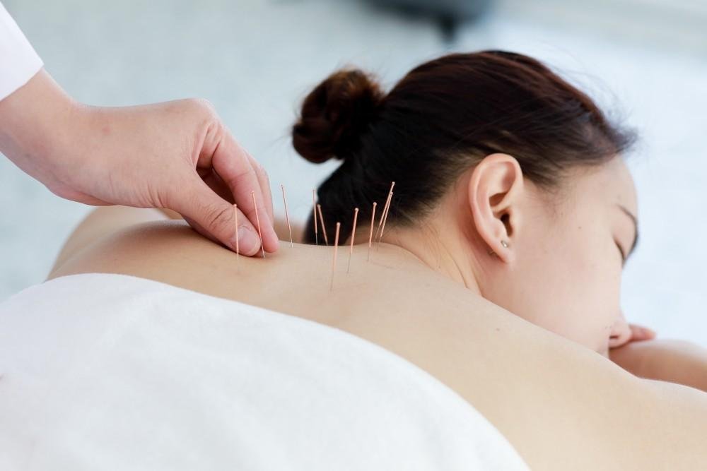 Acupuncture Clinic In Delhi