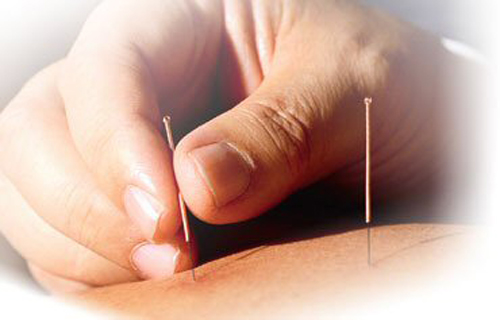 Acupuncture Course in delhi